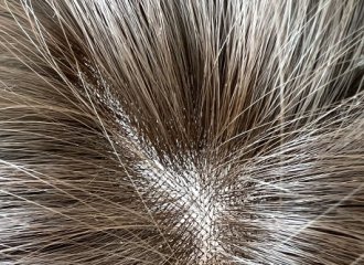 モノスキンネット（MONO SKIN NET）の植え方の紹介